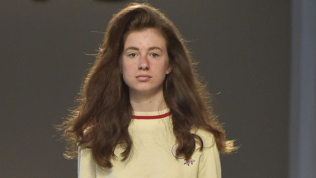 Onko akneiho pian muodikas?