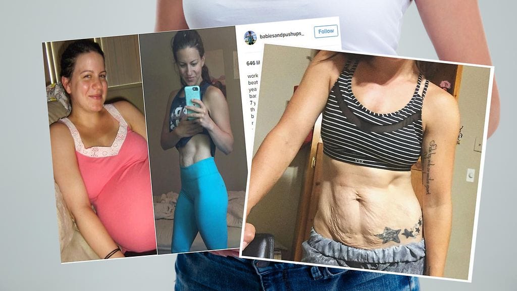 Kolmen lapsen äiti on oppinut hyväksymään raskauksien myötä muuttuneen vartalonsa.
