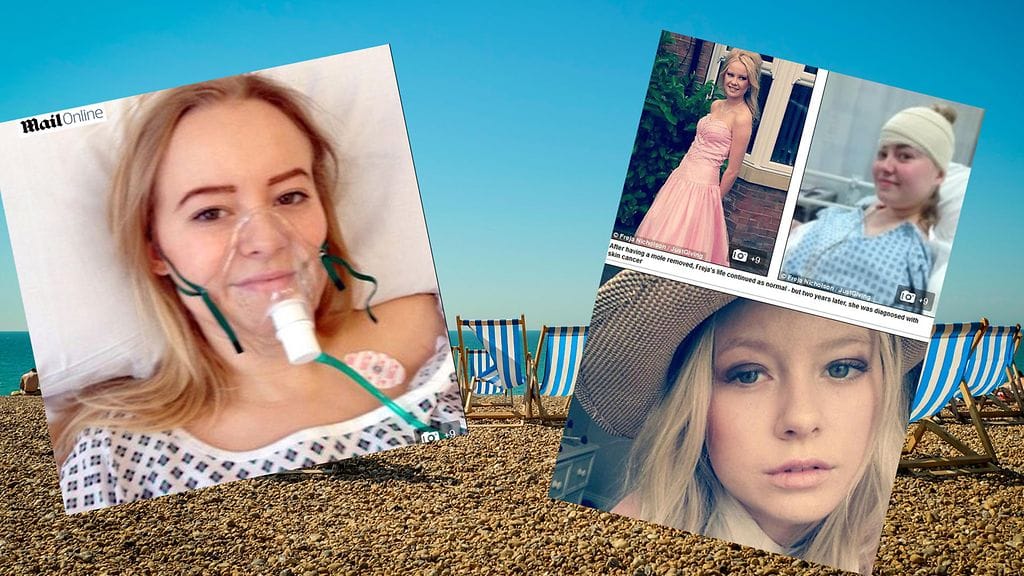 18-vuotias Freja kuoli ihosyöpään, koska hän altistui lapsena auringolle.
