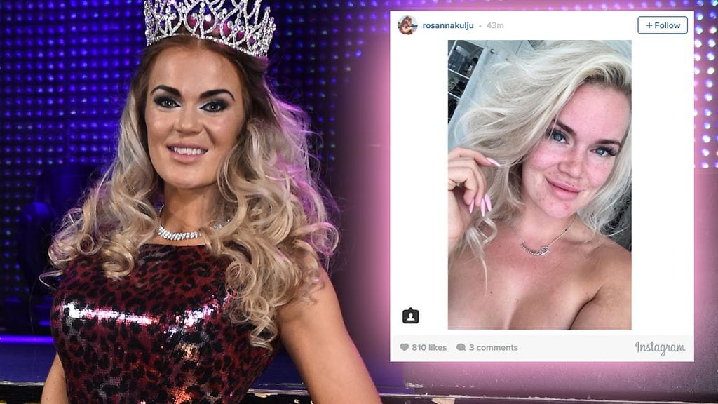 Rosanna Kulju meikillisenä 9. tammikuuta 2015 ja meikittömänä 6. heinäkuuta 2016.