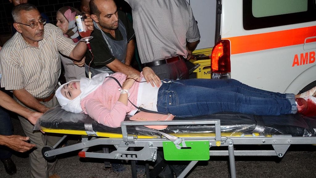 Haavoittunut nainen saapuu paareilla sairaalaan Syyrian hallituksen hallitsemassa Aleppon pohjoisosassa 8. heinäkuuta 2016.