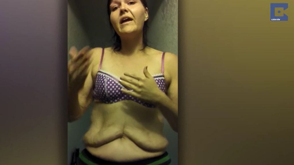 Tanya Benedict, 35, painoi ennen käsittämättömät 175 kiloa; hän eli sokeriherkuilla ja McDonaldsin tuplajuustohampurilaisilla.