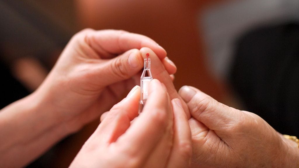 Diabeteksessa verensokeri eli glukoosi on jatkuvasti koholla.