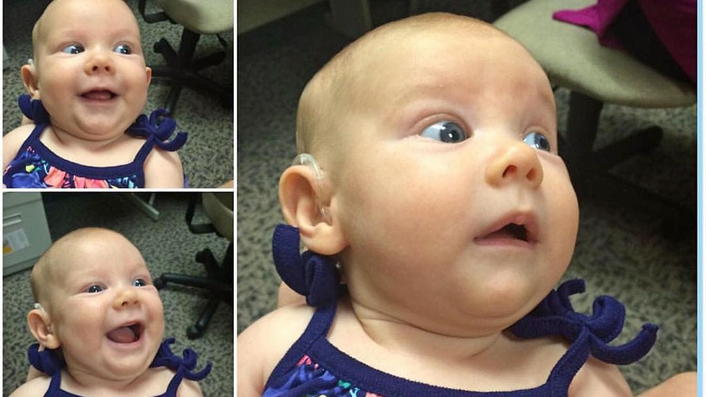 Vauva ei pysty peittelemään iloaan kuulolaitteen saatuaan.