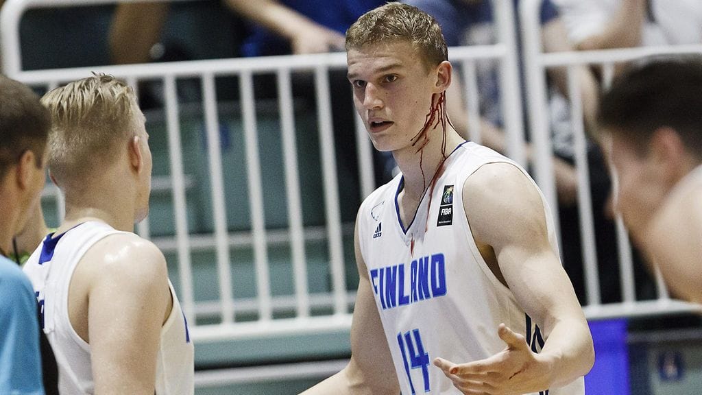 Lauri Markkanen joutui jättämään kentän toisen neljänneksen lopussa, mutta pääsi tauon jälkeen jatkamaan ottelua.