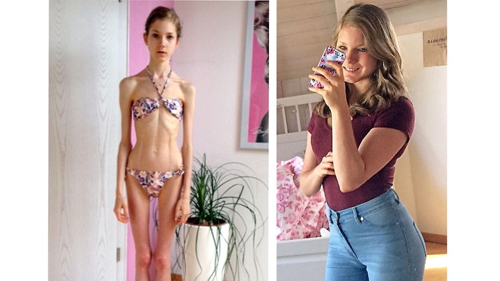 Chiara Schober on käynyt läpi pitkän paranemisprosessin, mutta elää nykyisiin täysin tervettä elämää.