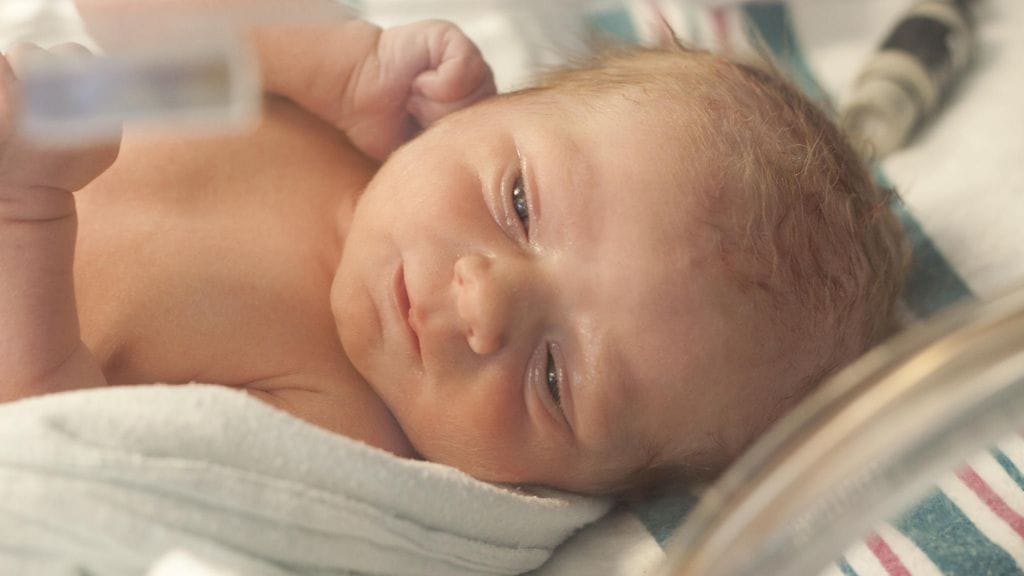 Suurin osa vatsahalkio-diagnoosin saaneista lapsista selviää hengissä.