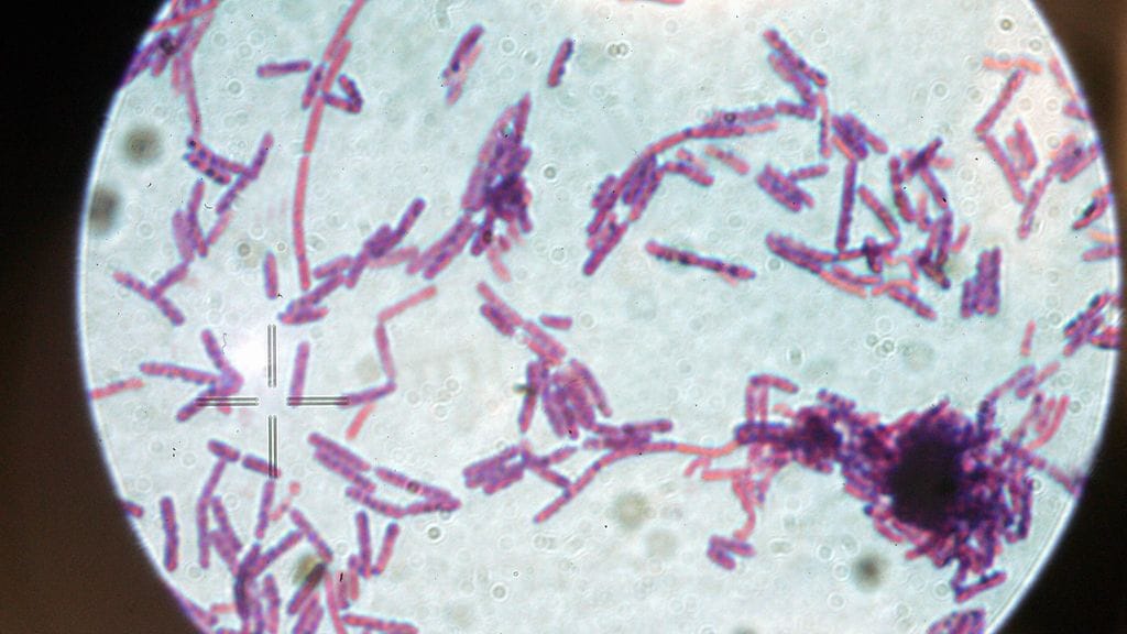 Kuvituskuvaa. Eläinlääkintä- ja elintarviketutkimuslaitoksen Eelan laboratoriossa tutkitaan pernaruttonäytteitä.