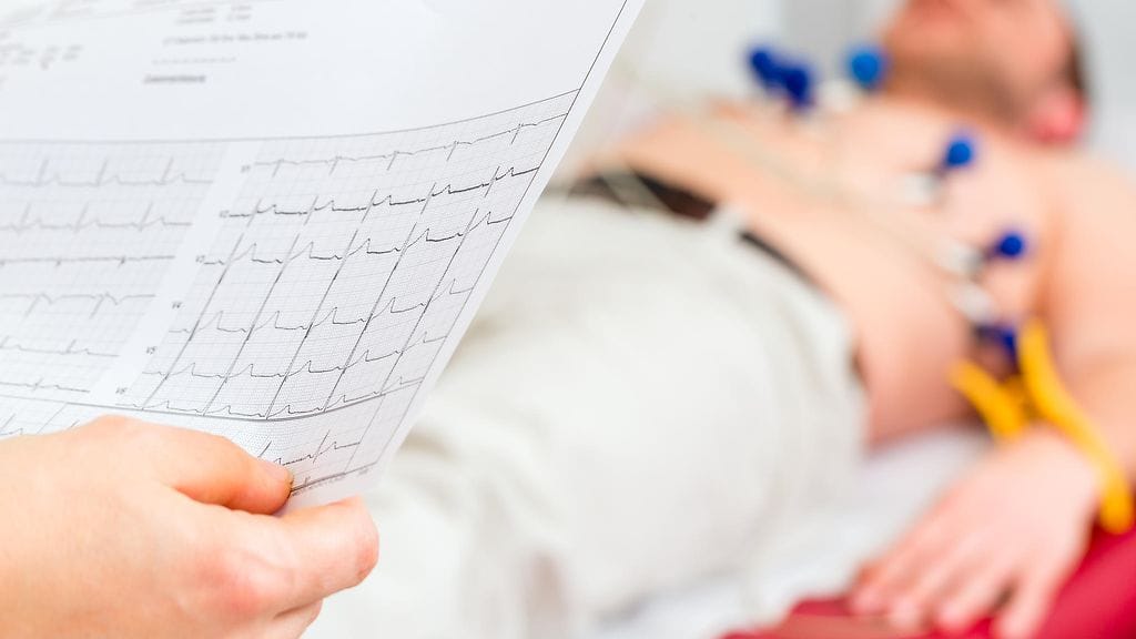 Jos rytmihäiriöitä kokee rasituksessa, on syytä huolestua. Kuvituskuva.