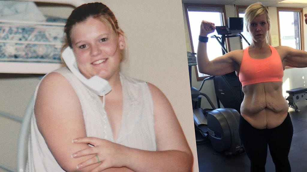 Nicole Castrovince ennen ja nyt.