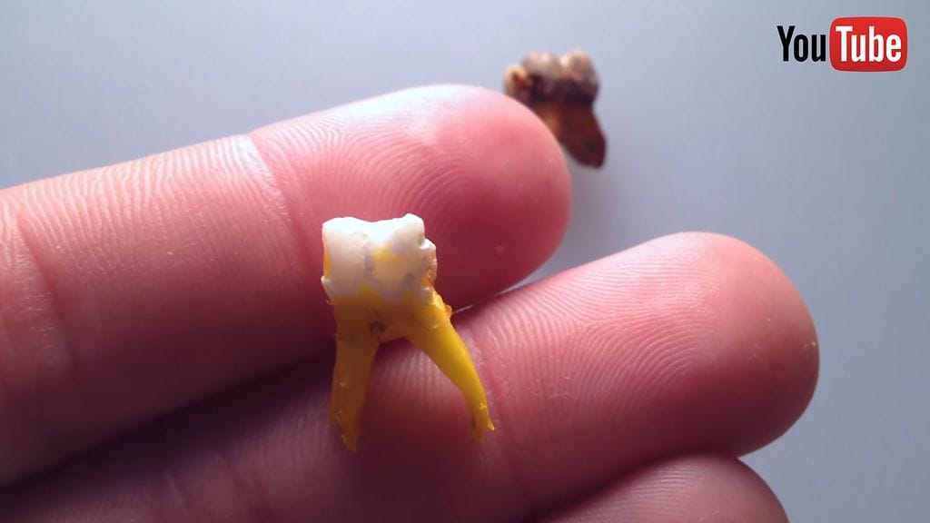 Kolmen viikon liotuksen jälkeen hampaat näyttävät hurjilta.