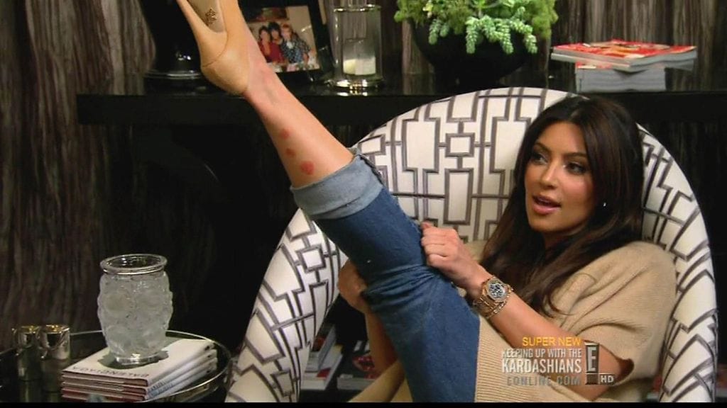 Kim Kardashian psoriasis (4)