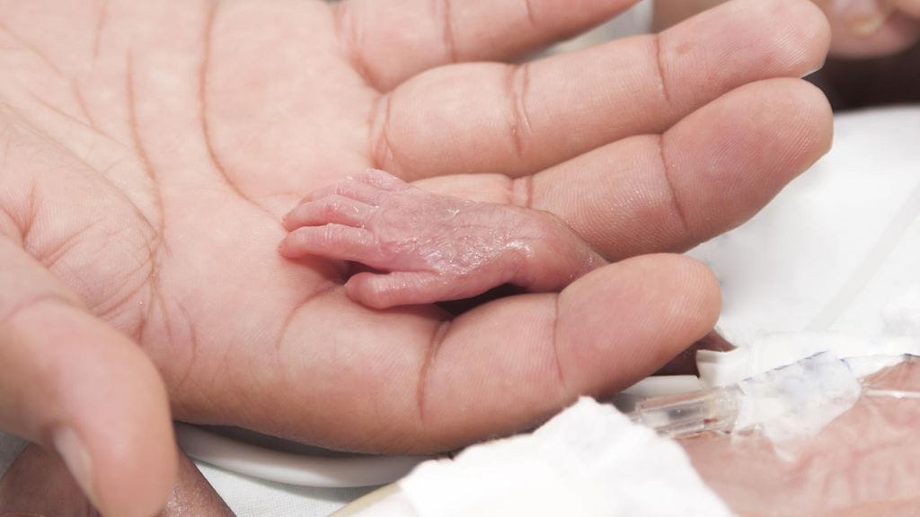 Todella pienestä saksalaisvauvasta tuli maailman pienin eloonjäänyt lapsi.