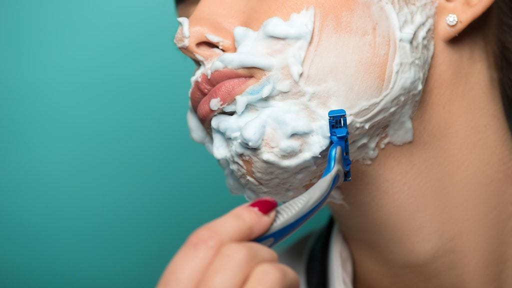 Monirakkulaoireyhtymän yleisin tunnusmerkki on liiallinen karvojen kasvu.