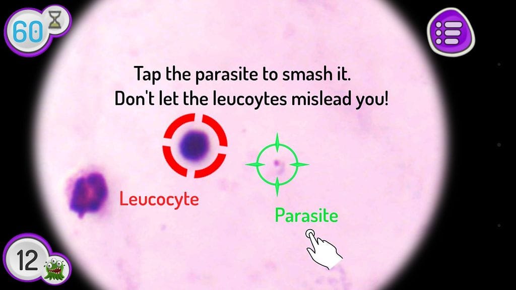 Malariaspot-pelissä digitoiduista verinäytteistä tunnistetaan malarialoisia.