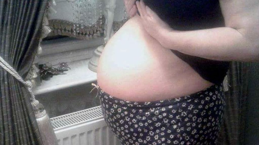 Nainen epäilee, että kasvain ehti kasvaa hänen vatsassaan jopa kolmen vuoden ajan.