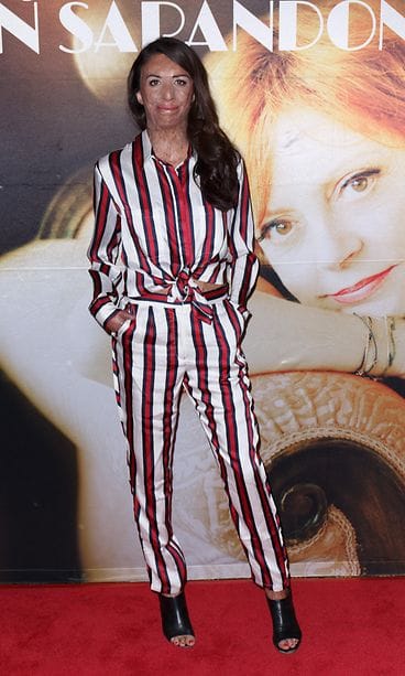 Turia Pitt elokuu 2016