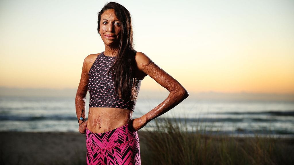 Turia Pitt maaliskuu 2016