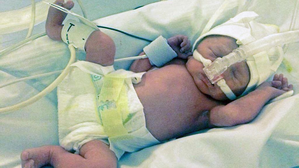 Pieni Felicity-tyttö syntyi kymmenen viikkoa ennen laskettua aikaa, ja joutui veittämään ensimmäiset elinviikkonsa tehohoidossa.
