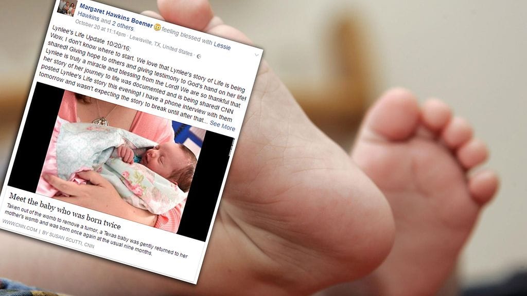 Vauva alkoi voida päivä päivältä huonommin, jolloin lääkärit päättivät, että on pakko toimia.