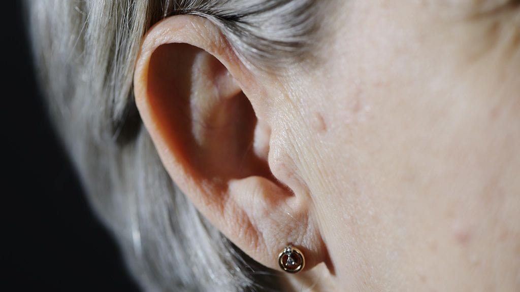 Tutkimuksessa dementiaan viittaavia testituloksia sai noin 15-24 prosenttia niistä, joiden jokin aisti oli huonontunut.