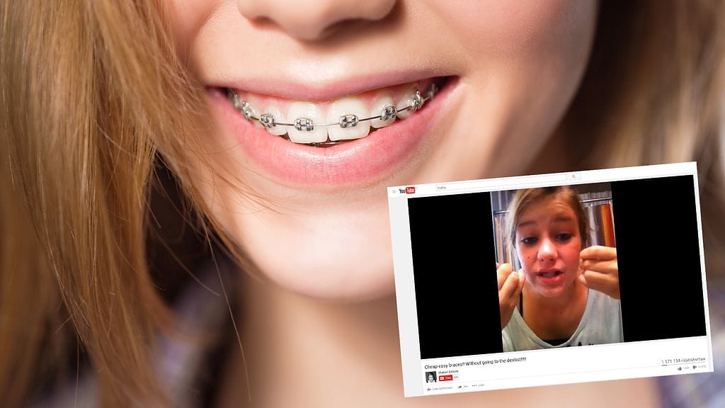 Teinien keskuudessa leviävällä ilmiöllä voi olla tuhoisia seurauksia.