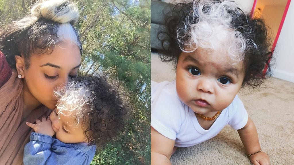 Brianna Worthyn ja hänen puolitoistavuotiaan tyttärensä hiuksissa on yhtenevä syntymämerkki.