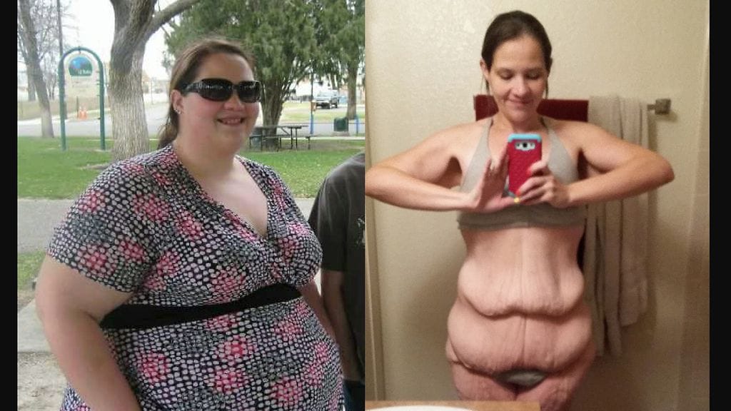 Lähes koko elämänsä ajan kiusaamista kokenut nainen päätti muuttaa elämänsä suunnan tyttärensä vuoksi.