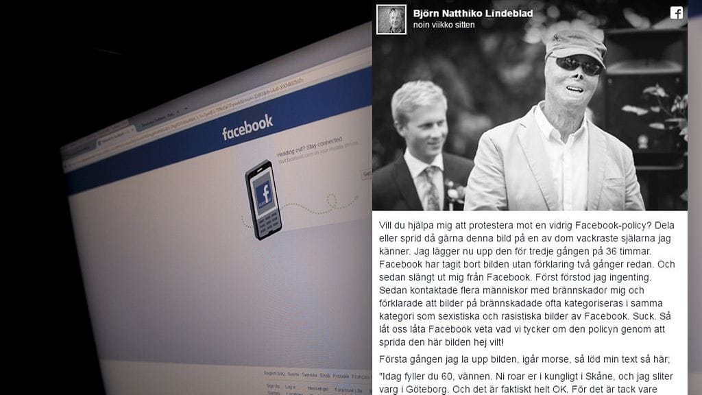 Työtehtävissä vammautuneen palomiehen kuva oli liikaa Facebookille. Myöhemmin yhtiö pahoitteli menettelyään.