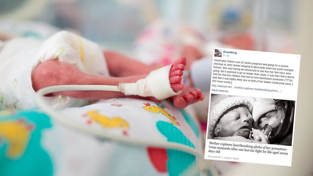 Äiti sai otettua koskettavan kuvan lapsistaan vain tuntia ennen, kuin toinen heistä nukkui pois.