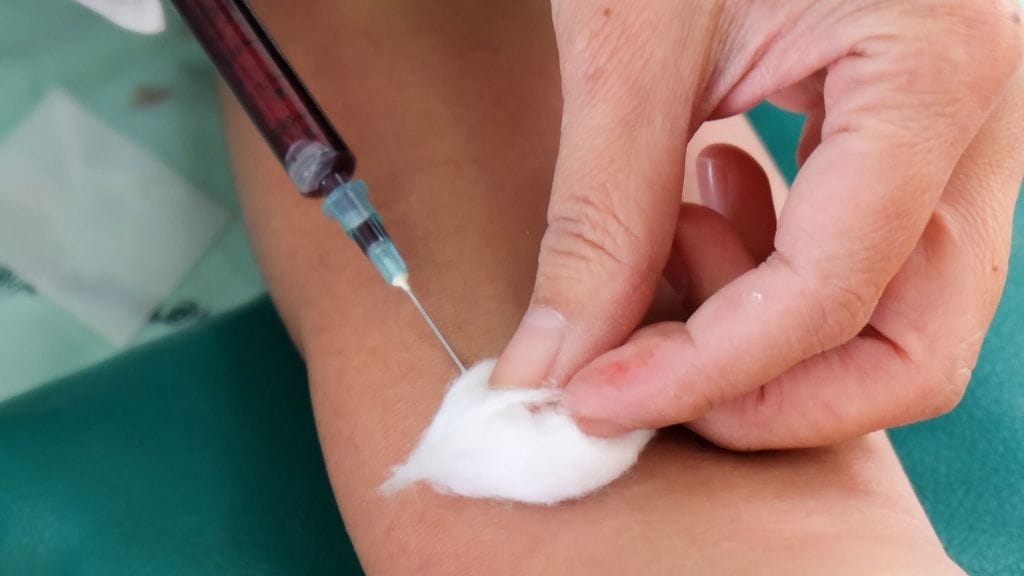 Hemoglobiiniarvo alentuu anemiassa.