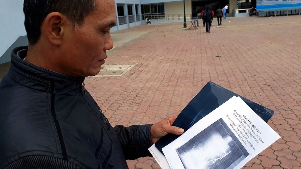 Sakset jäivät Nhatin vatsaan vuonna 1998 suoritetun leikkauksen yhteydessä.