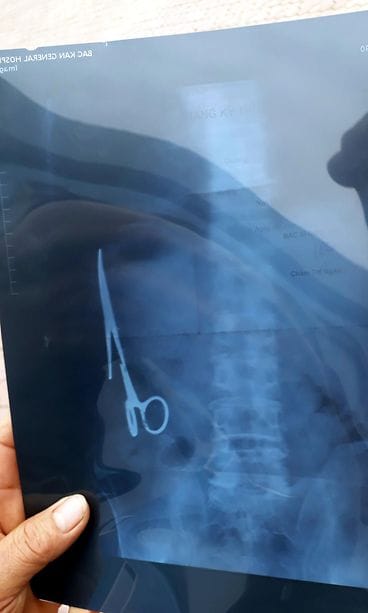 sakset, Ma Van Nhat (1)