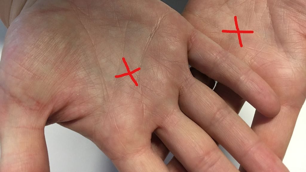 Kun kummastakin kädestä löytyy oikeasta kohtaa X-merkki, liitetään ihmiseen tiettyjä uskomuksia.