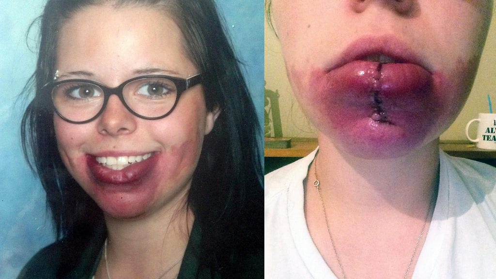 Tamara kouluaikana sekä toipumassa operaatiosta, joka hänelle on tehty.