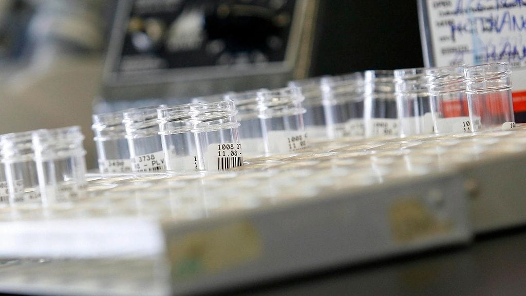 Superbakteerit ovat bakteereita, jotka ovat kehittäneet vastustuskyvyn useimpia yleisiä antibiootteja vastaan.