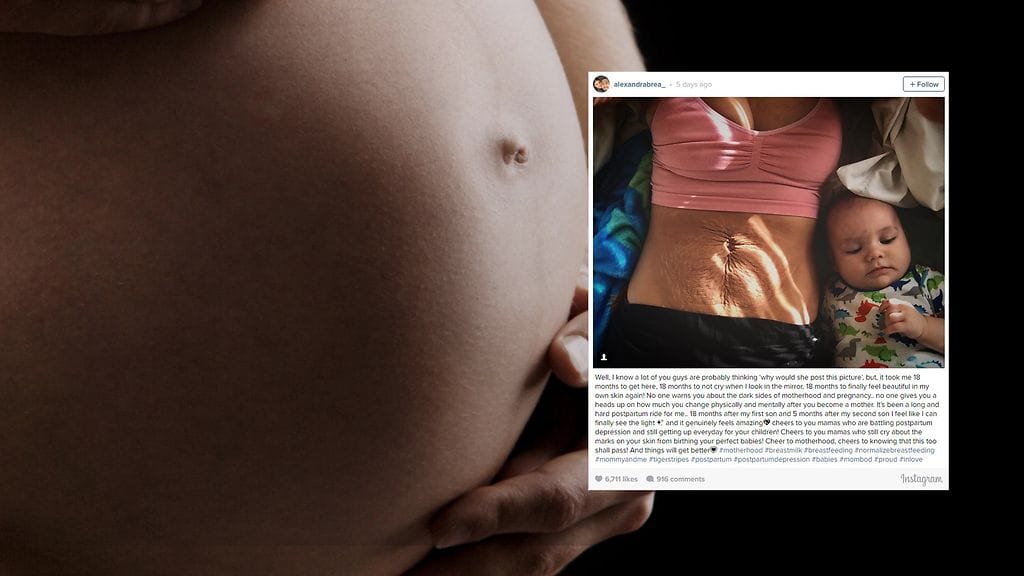 Äidin mukaan naisten voi olla vaikea suhtautua kehonsa muutoksiin raskauden jälkeen.