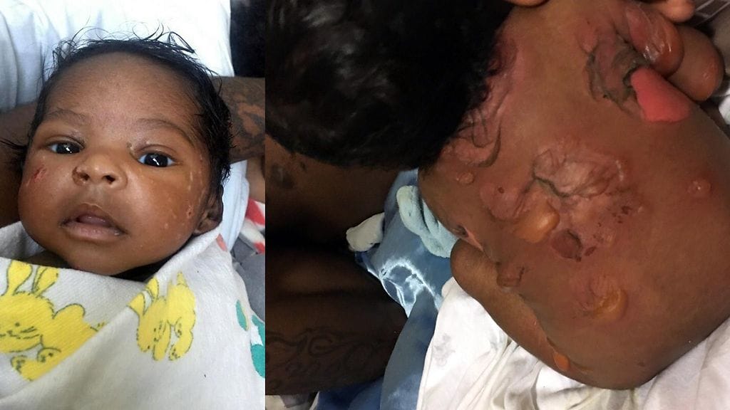 Kolmiviikkoinen Kahleel.