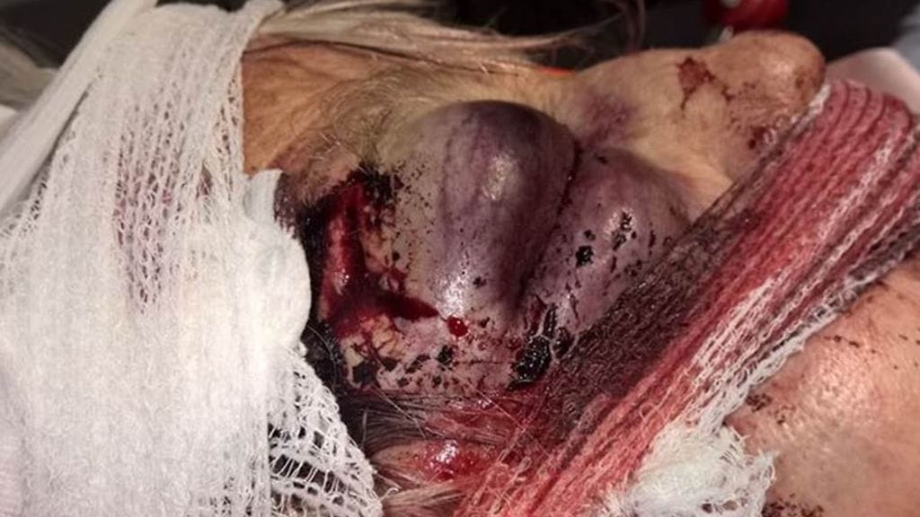 Poliisin julkaisemat kuvat vanhuksesta järkyttävät.