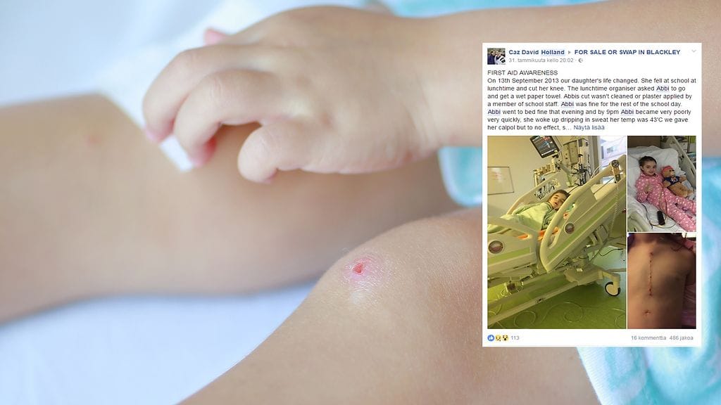 Naarmusta infektion saanut Abbi Holland on toipumassa vaativasta leikkauksesta.