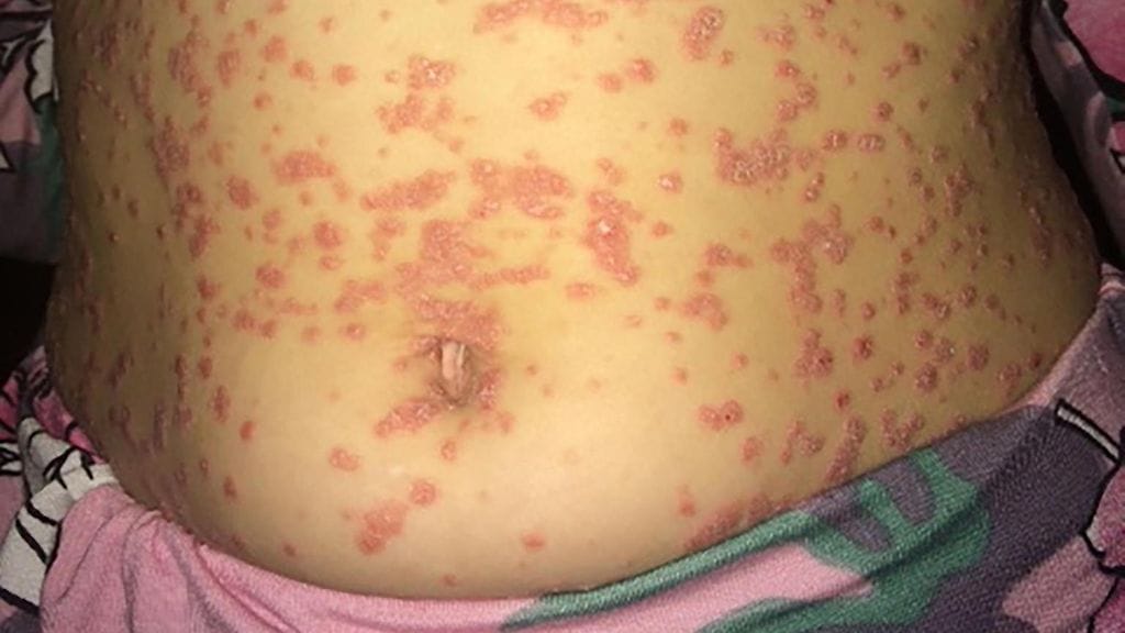 Photography "0315545143"