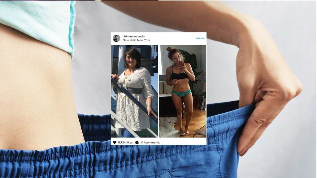 Hurjasti laihtunut nainen kertoo olleensa ennen paljon itsevarmempi kuin nyt, monta kymmentä kiloa kevyempänä.