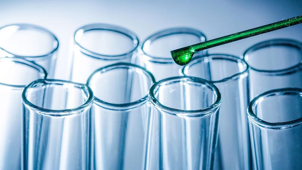 Virtsan väriin vaikuttaa moni tekijä.