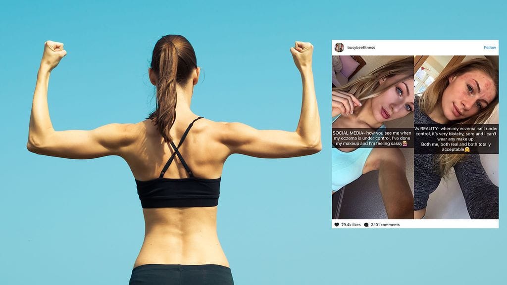 Instagram-tähti kertoo, että kuvaparin julkaiseminen merkitsi hänelle paljon.