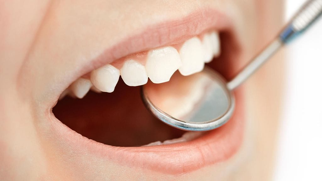 Ruokavaliolla on tärkeä rooli kariesbakteeritartunnassa.