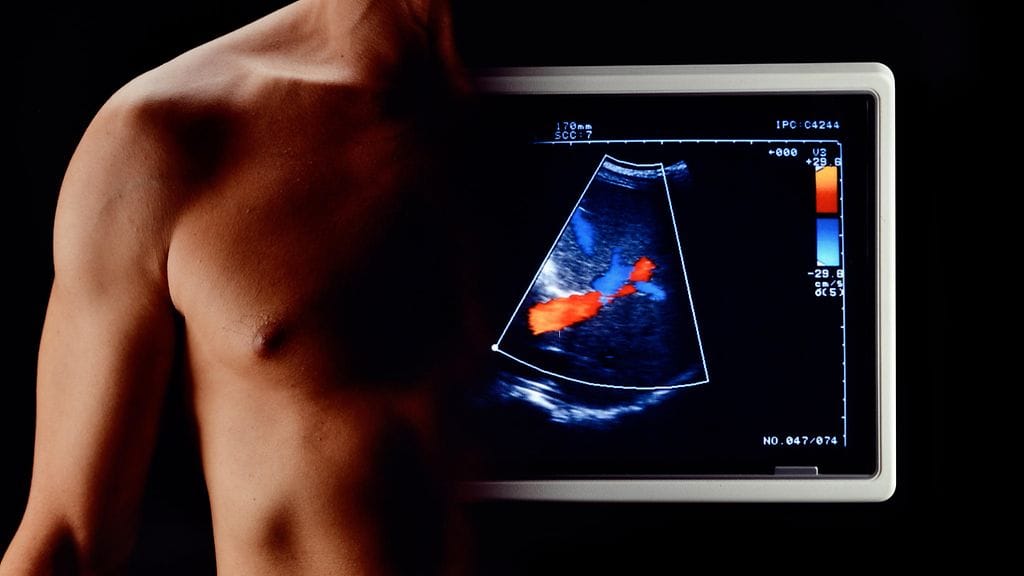 Sydänoireiden riski oli tuoreessa seurannassa viisinkertainen niillä, joiden sepelvaltimoissa oli kalkkeutumista. Kuvituskuva.