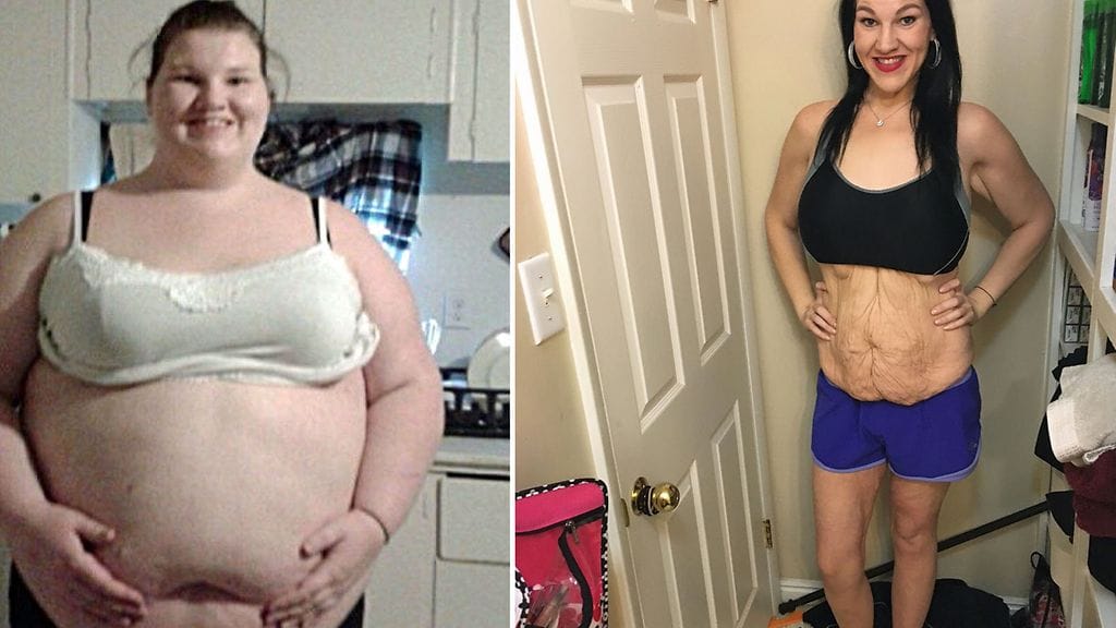 Kuvat todistavat naisen valtavaa muodonmuutosta.