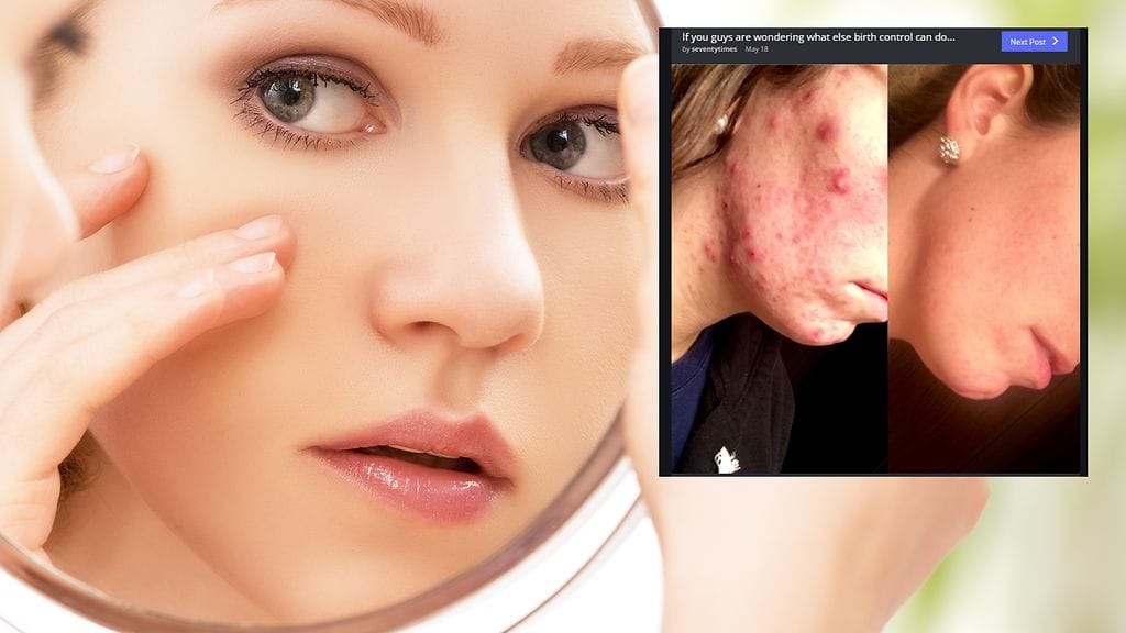 Kuvituskuva Shutterstock, toisen kuvan lähde Imgur.