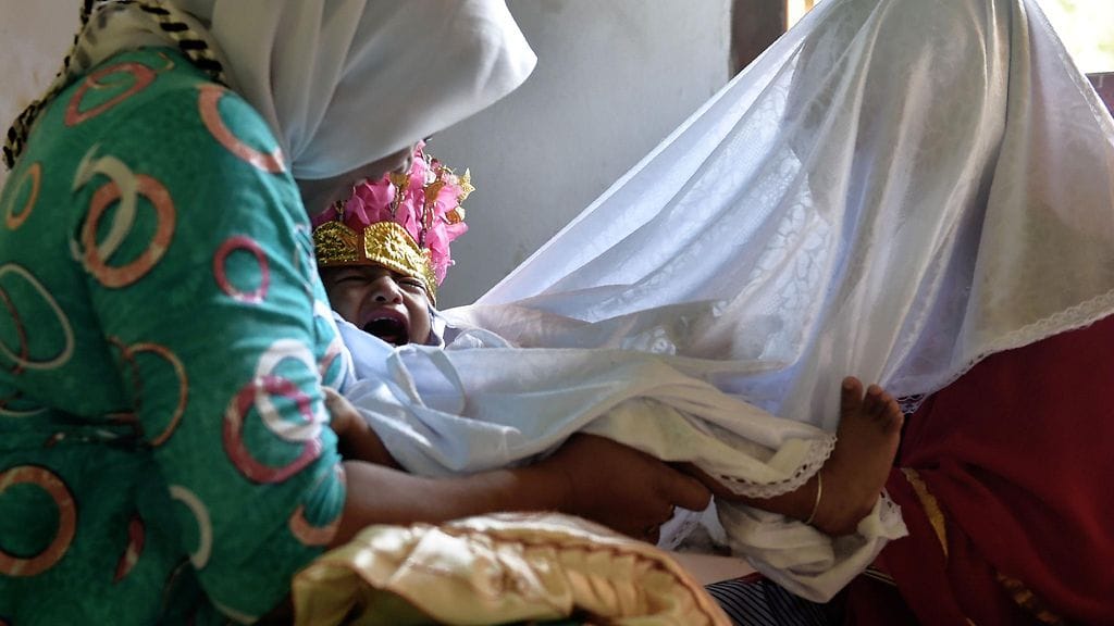 1,5-vuotias Salsa itkee, kun paikallinen parantaja ympärileikkaa lasta.