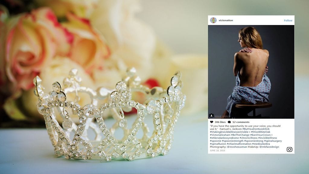 Lähes koko ikänsä sairauttaan piilotellut nainen on kohdannut elämänsä aikana paljon väärinymmärryksiä.